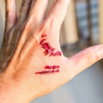 Photo illustration of a dog bite. An experienced attorney can help file a dog bite claim and get on the road to recovery.